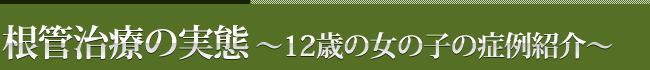 根管治療の実態～12歳の女の子の症例紹介～