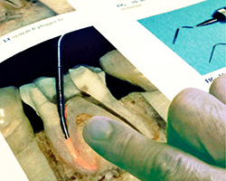 当院の院長は歯内療法の専門医です