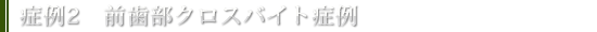 症例2　前歯部クロスバイト症例