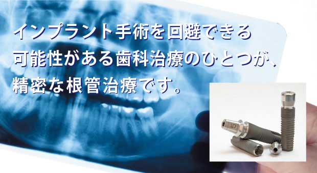 インプラント手術を回避できる可能性がある歯科治療のひとつが、精密な根管治療です。